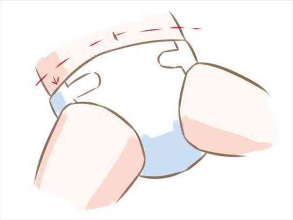 纸尿裤遮住肚脐的危害