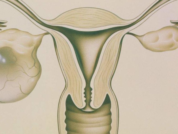 卵巢囊肿的六个主要症状