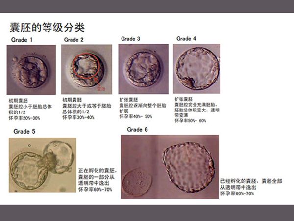 泰国试管婴儿6ac囊胚移植成功较高