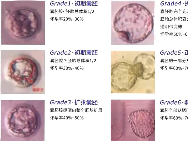 試管胚胎等級與成功率的關係緊密