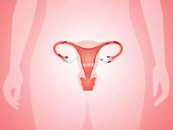 女性过多服用雌激素也能导致子宫内膜增厚