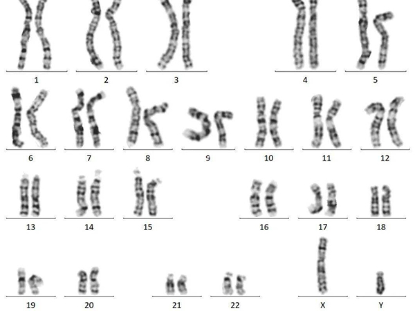 染色体检查结果怎么看