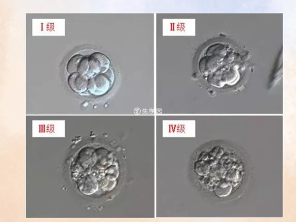 胚胎等级可以划分为四个等级
