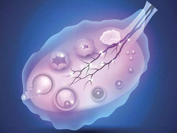 卵泡囊腫與卵泡定義不同