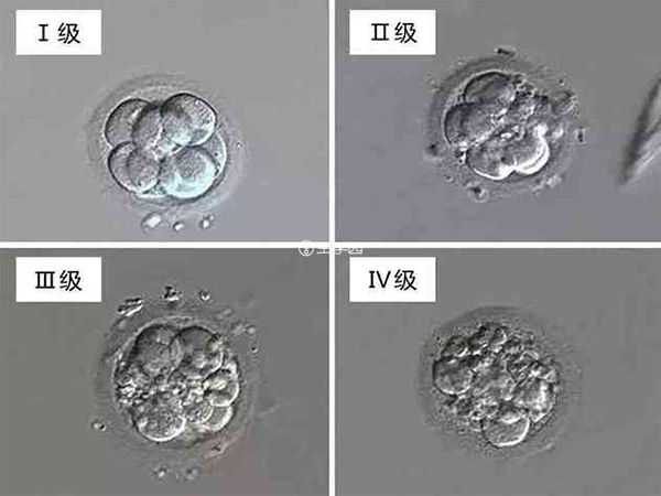 通常将试管婴儿的胚胎分为四级