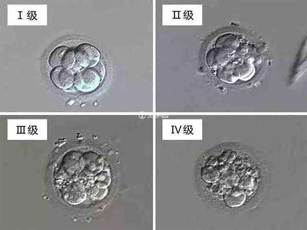 2pn胚胎移植成功率还是比较高的