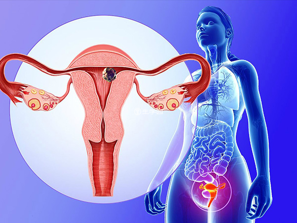 子宫及双附件状态不佳不宜移植胚胎
