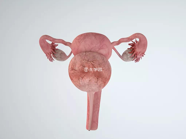 子宫畸形是导致女性不孕的妇科疾病之一