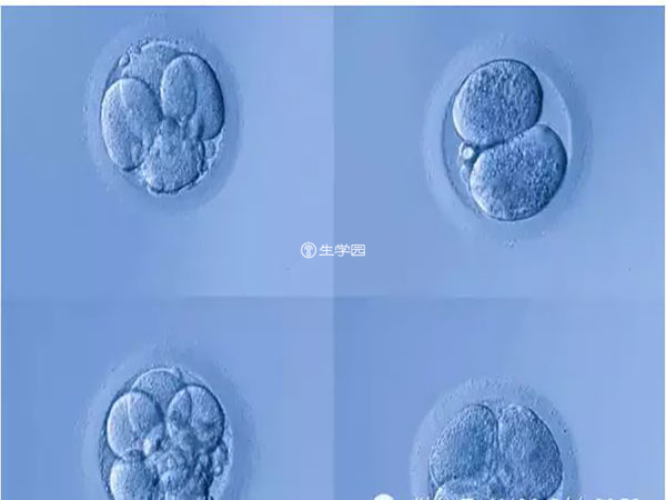 自然周期要定期监测卵泡发育