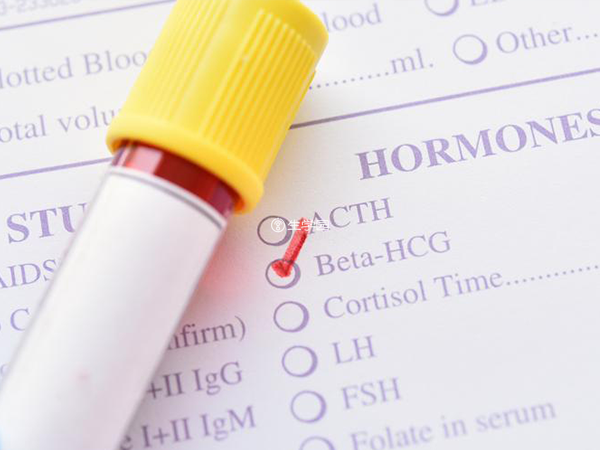 女性体内hcg激素检验报告单
