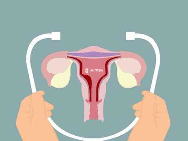 子宫内膜需检查哪些项