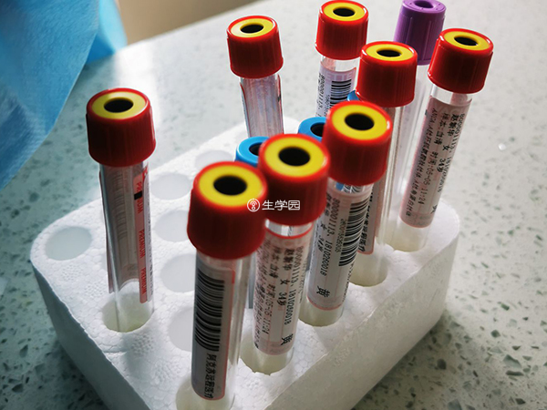 HIV患者洗精前要先抽血检查