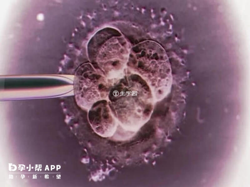 胚胎质量可以决定要不要养囊