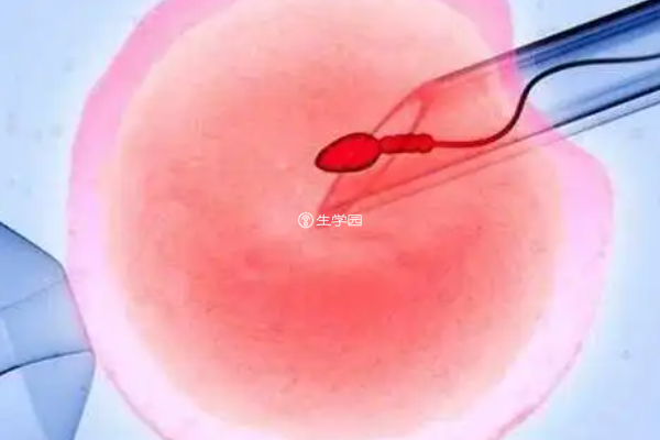 详解什么是精子dna碎片化